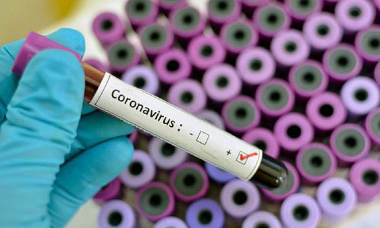 Koronavirus potvđen kod 384 osobe u RS, 21 smrtni slučaj
