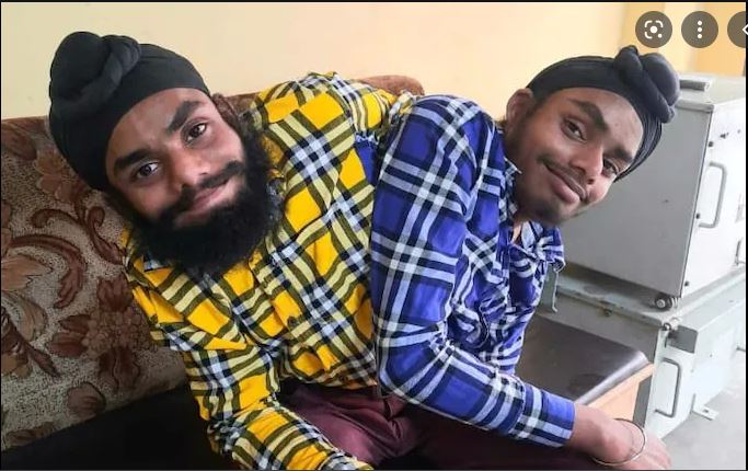 Indija: Posao dobili sijamski blizanci koje ljekari nisu razdvojili zbog prevelikog rizika