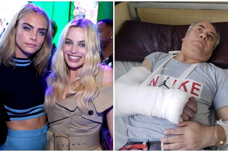 Fotograf tvrdi da su ga napali prijatelji Care Delevingne i Margot Robbie: Idem na operaciju