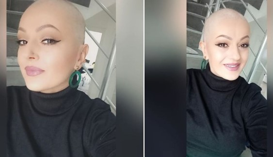Aida Babić o borbi protiv karcinoma dojke: Odlučila sam da je moja kosa jedina stvar koju ću dati raku