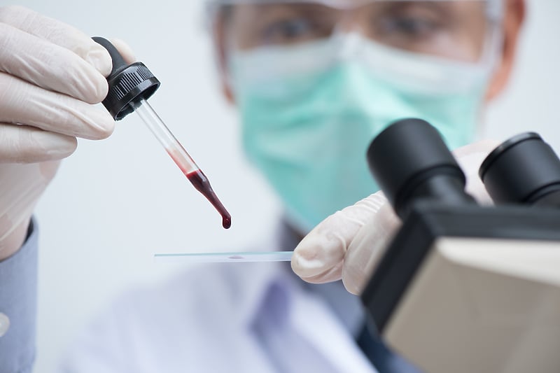 Prvi put izvršena transfuzija krvi koja je napravljena u laboratoriji